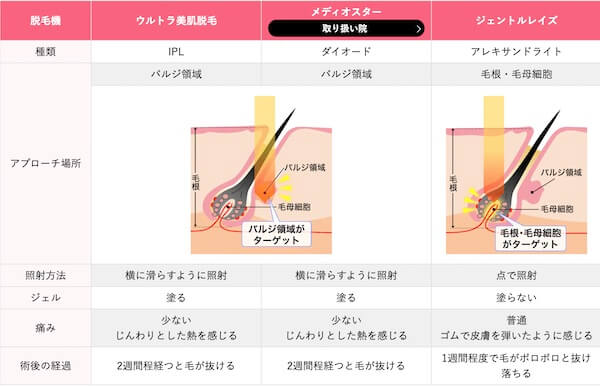 湘南美容クリニック 脱毛機