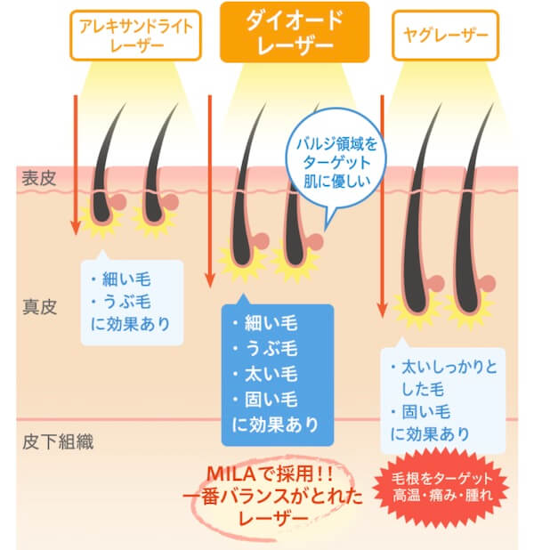 ミラクリニック レーザー