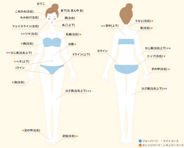 ミラクリニック 脱毛範囲